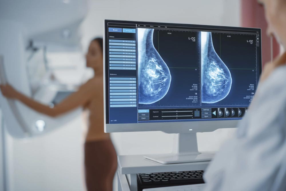 mamografia con implantes mamarios malaga